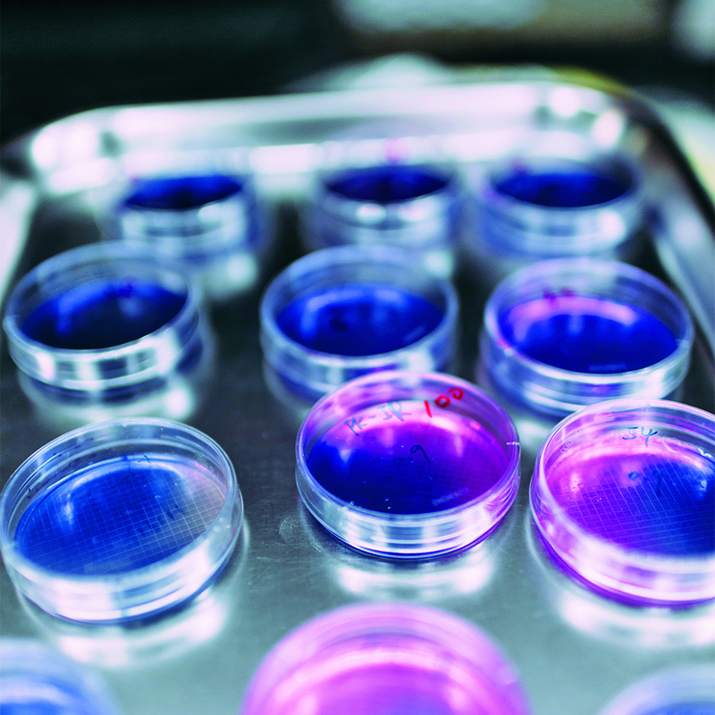 Several Petri dishes rest on a steel tray under a purplish lighting.