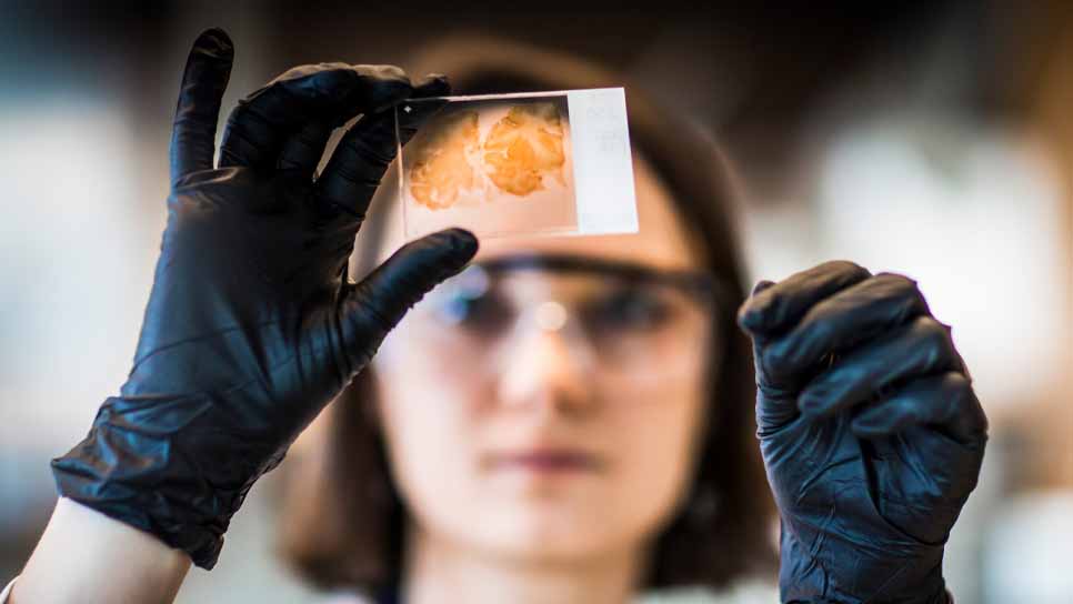 female scientist examines slide