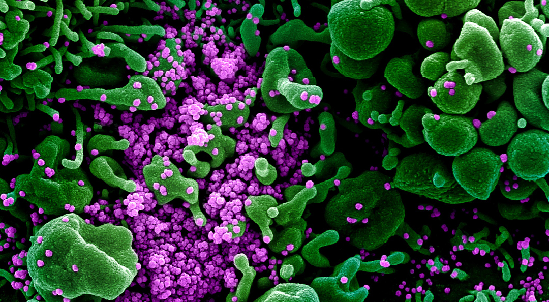 microscopic image of novel 2019 coronavirus